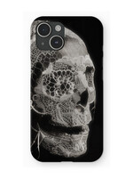 Vintage Laced Skull iPhone Case