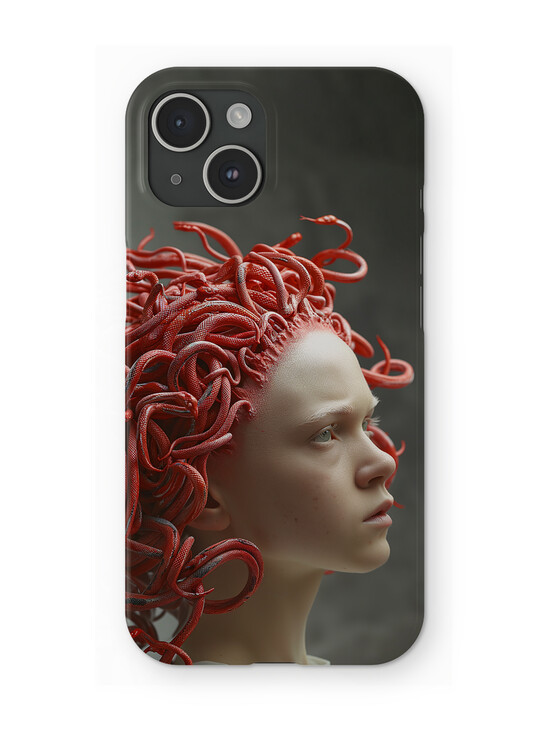 Albino Medusa iPhone Case